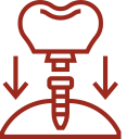 Implant Dentistry