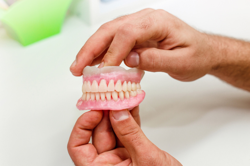 Implant-Supported Dentures