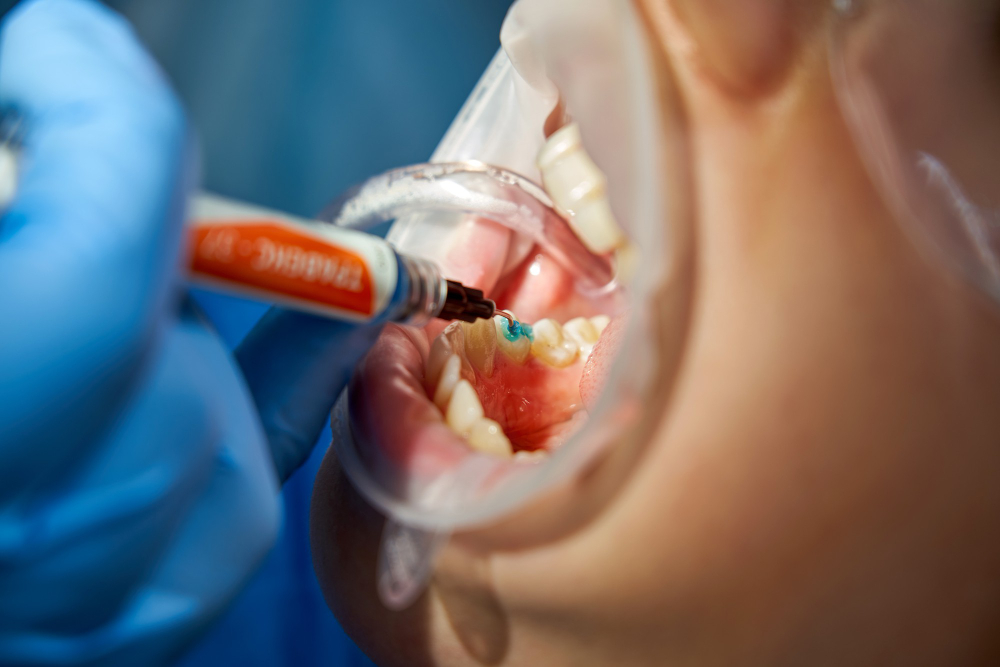 Gum Disease Treatment